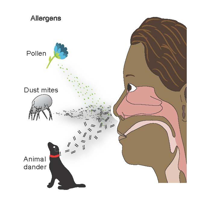 rhinitus allergie